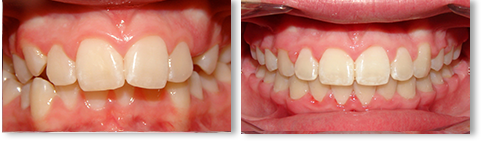 before-after-03